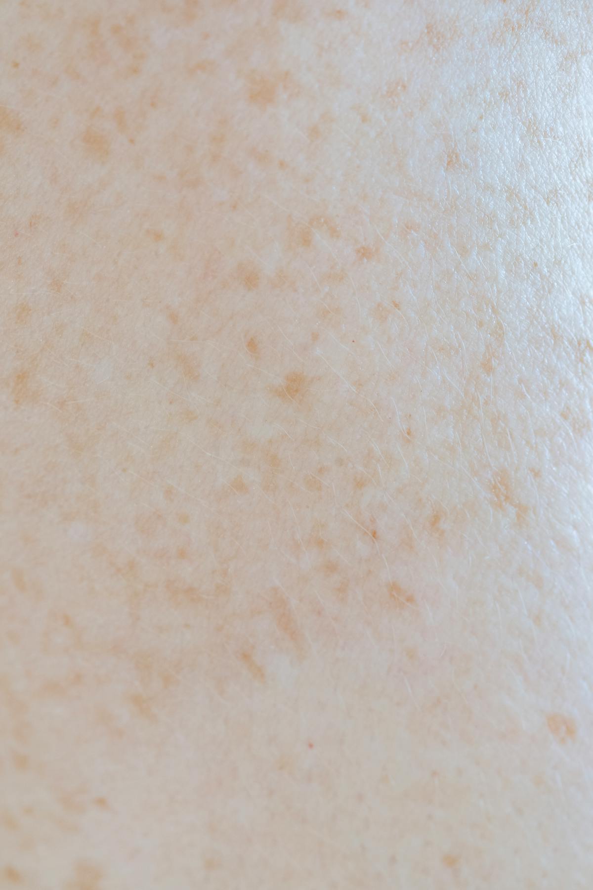 Macro close-up of human skin showing freckles and natural pigment variation