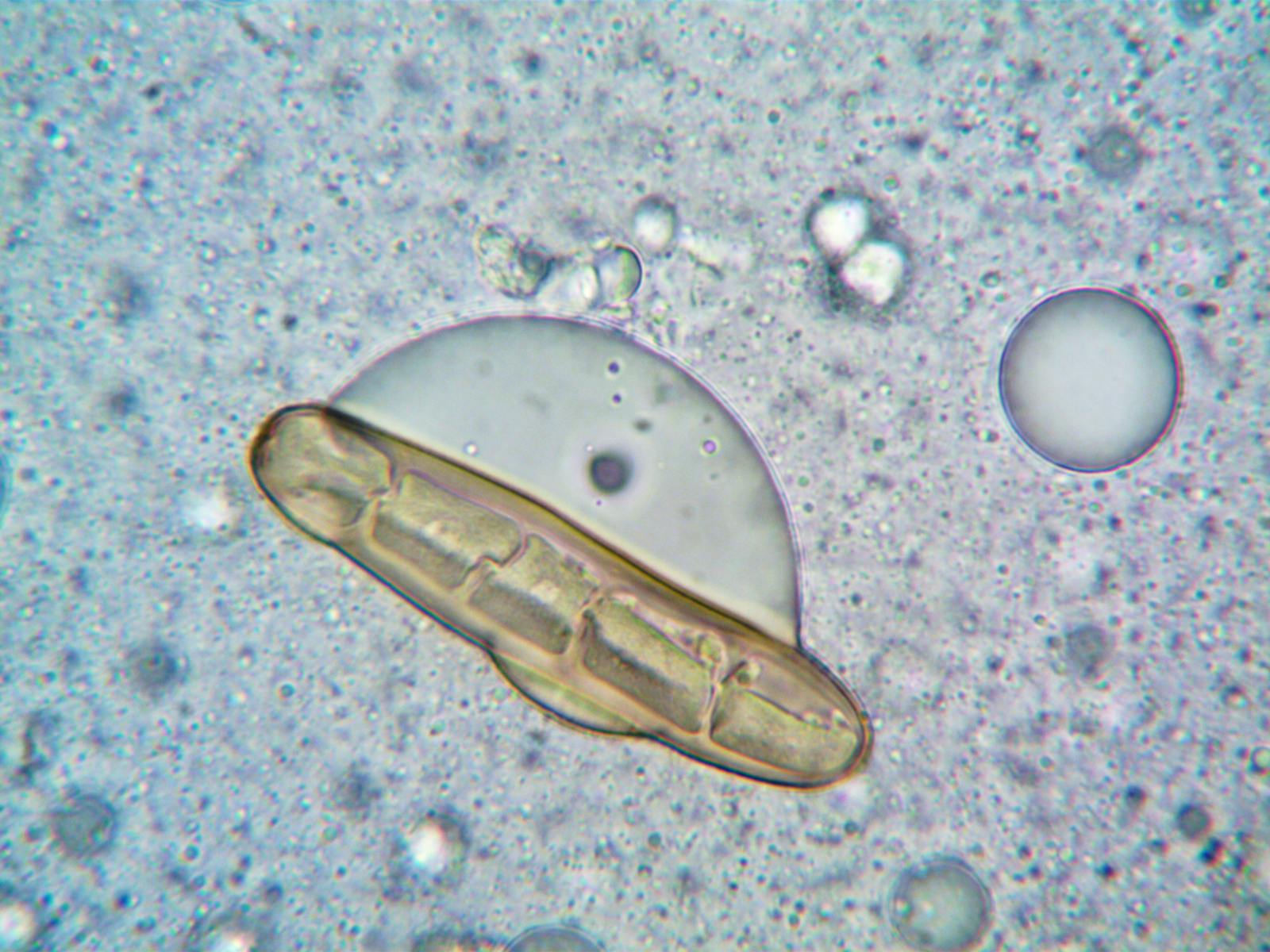 High-magnification microscopy image of cellular structures