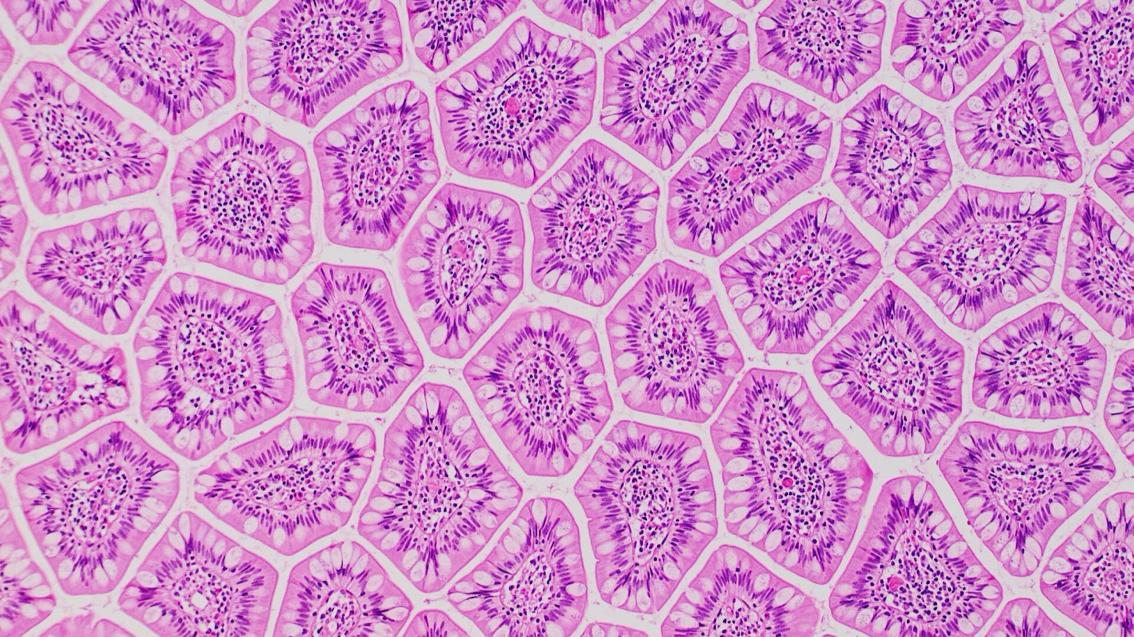 Histological cross-section showing intestinal villi of the small intestine