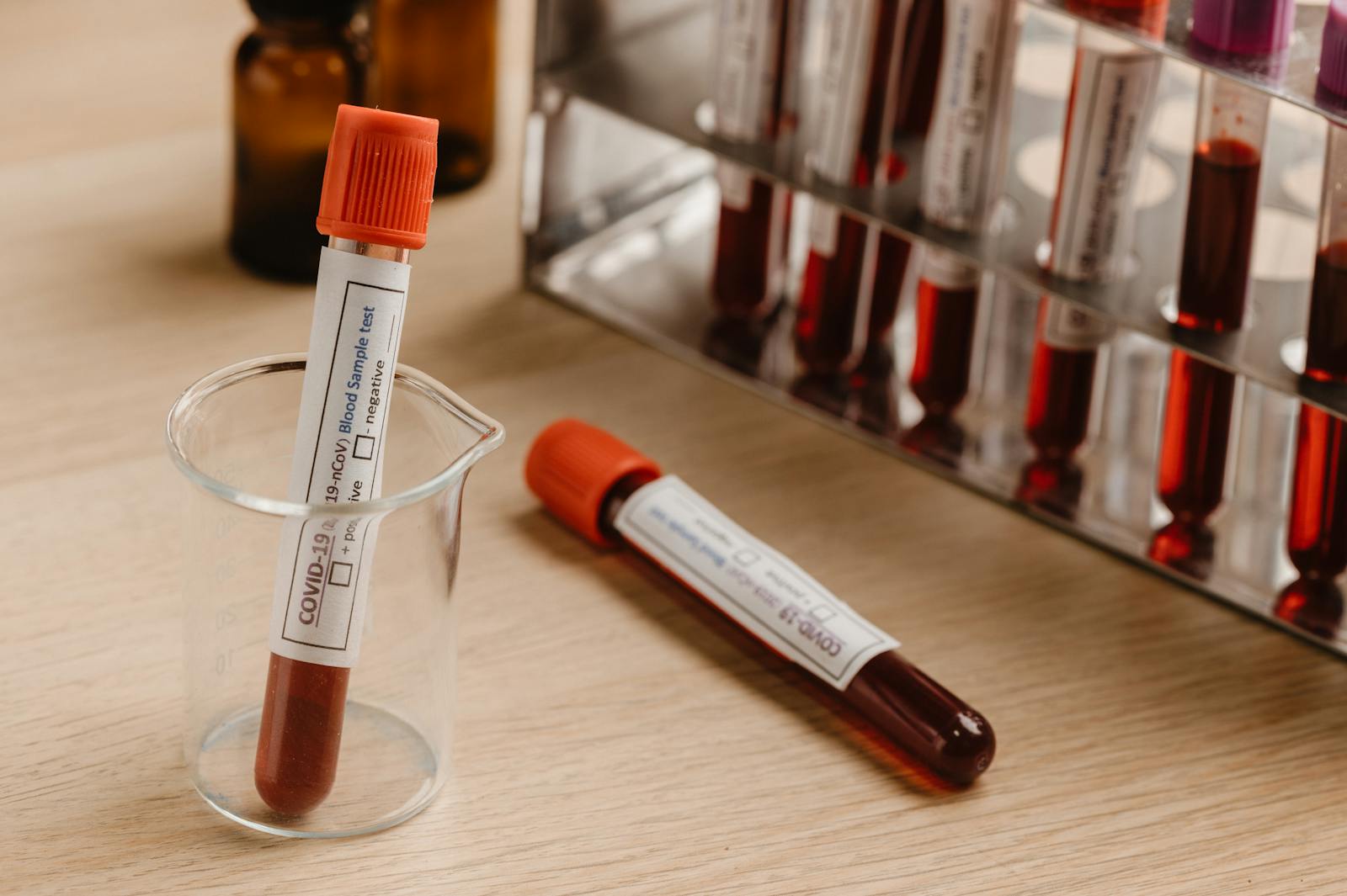 Close-up of blood collection tubes with red caps arranged in a laboratory